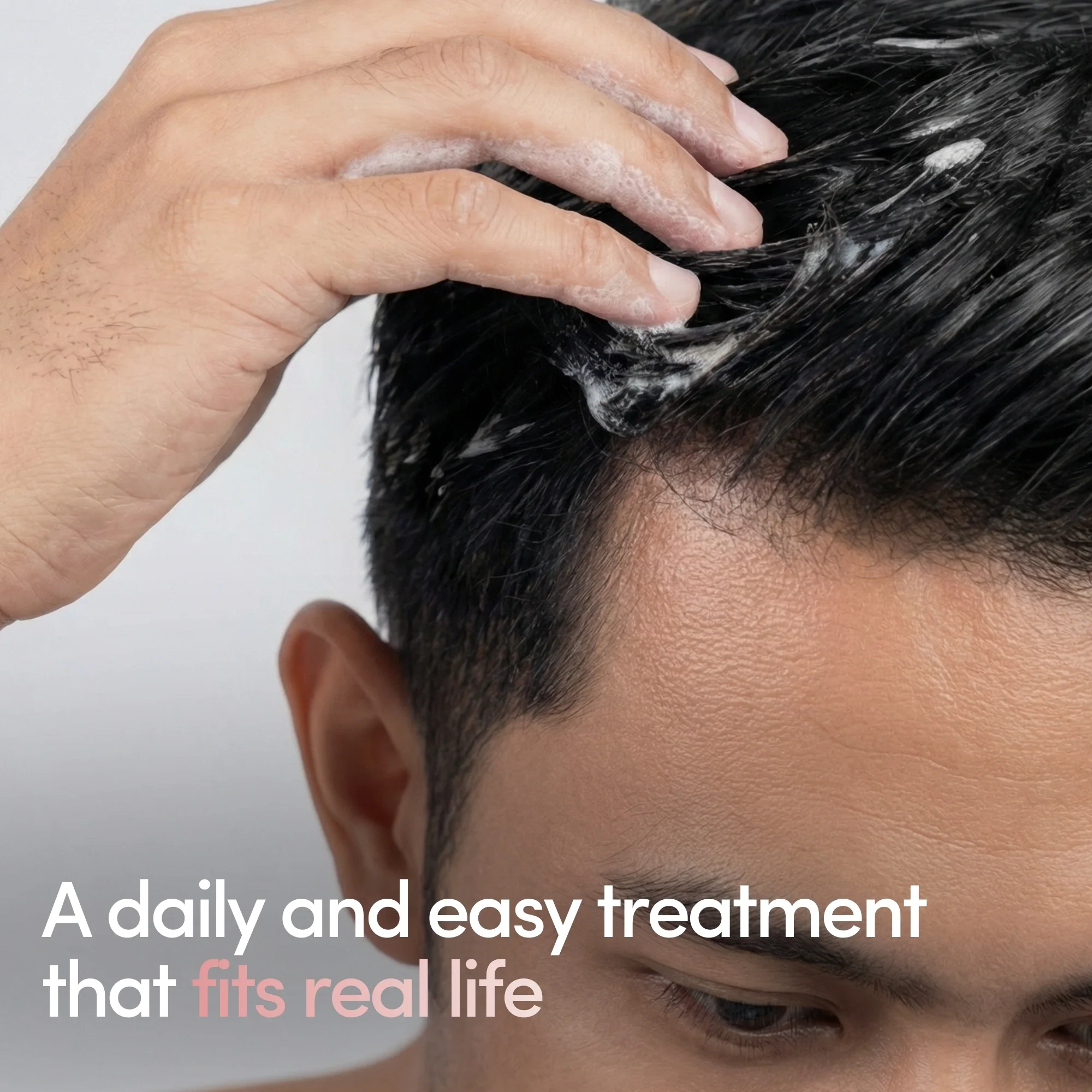 Hair Regrowth Foamʳˣ - Image 5